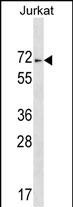 Rabbit Polyclonal Antibody to ZNF613