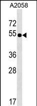 Rabbit Polyclonal Antibody to NHEDC2