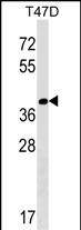 Rabbit Polyclonal Antibody to NTAN1