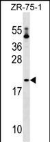 Rabbit Polyclonal Antibody to PTRH1