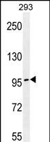 Rabbit Polyclonal Antibody to TCERG1