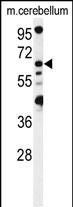 Rabbit Polyclonal Antibody to MON1B  (C-term)