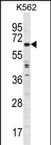 Rabbit Polyclonal Antibody to TRIM75