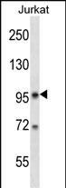 Rabbit Polyclonal Antibody to SR140 (N-term)