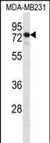 Rabbit Polyclonal Antibody to SLFN12