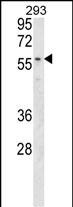 Rabbit Polyclonal Antibody to MBOAT2