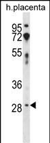 Rabbit Polyclonal Antibody to CD200