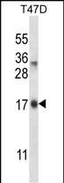 Rabbit Polyclonal Antibody to IGF2AS