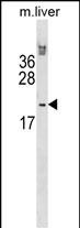 Rabbit Polyclonal Antibody to Mouse Hoxb6 (N-term)