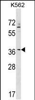Rabbit Polyclonal Antibody to ZNF385A (N-term)