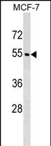 Rabbit Polyclonal Antibody to WDR20 (N-term)
