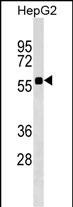 Rabbit Polyclonal Antibody to SRCRB4D