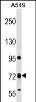 Rabbit Polyclonal Antibody to TMC4 (N-term)