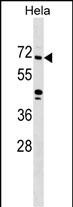 Rabbit Polyclonal Antibody to ZNF280B (N-term)