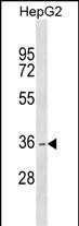 Rabbit Polyclonal Antibody to DHRS1