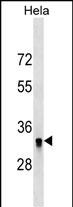 Rabbit Polyclonal Antibody to HIBADH (N-term)