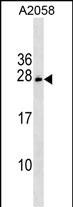 Rabbit Polyclonal Antibody to CHCHD6