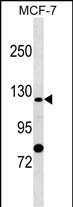 Rabbit Polyclonal Antibody to SLC4A9 (N-term)