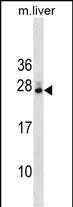 Rabbit Polyclonal Antibody to DNAJB9 (N-term)