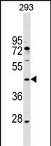 Rabbit Polyclonal Antibody to MAEA (N-term)