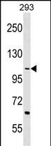 Rabbit Polyclonal Antibody to TEX2