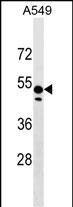 Rabbit Polyclonal Antibody to ZNF695