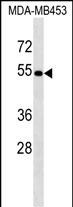 Rabbit Polyclonal Antibody to ACCS