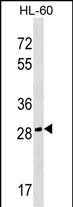Rabbit Polyclonal Antibody to CGREF1