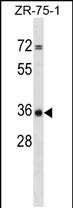 Rabbit Polyclonal Antibody to CPPED1