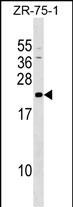 Rabbit Polyclonal Antibody to GRPEL1