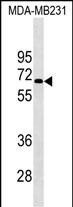 Rabbit Polyclonal Antibody to KCNF1
