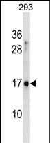 Rabbit Polyclonal Antibody to SYS1