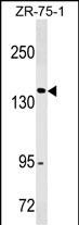 Mouse Monoclonal Antibody to ITGAX/CD11c (N-term)