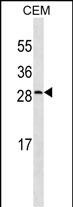 Mouse Monoclonal Antibody to CRP