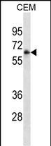 Mouse Monoclonal Antibody to FCGR3A