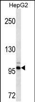 Mouse Monoclonal Antibody to DDR2(Ascites)