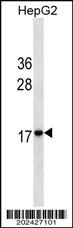 Mouse Monoclonal Antibody to HMG2
