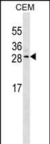 Mouse Monoclonal Antibody to EPO