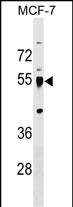 Rabbit Polyclonal Antibody to LRRC42