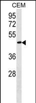 Rabbit Polyclonal Antibody to FBLN5