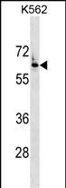 Rabbit Polyclonal Antibody to FZD7