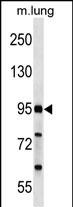 Rabbit Polyclonal Antibody to FCHO2