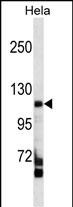Rabbit Polyclonal Antibody to FAM65C