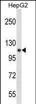 Rabbit Polyclonal Antibody to ANKRD18A (N-term)