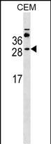 Rabbit Polyclonal Antibody to MS4A3