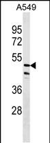 Rabbit Polyclonal Antibody to ZNF708 (N-term)