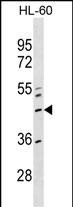 Rabbit Polyclonal Antibody to ZNF589