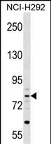 Rabbit Polyclonal Antibody to CRTAC1 (N-term)