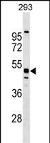 Rabbit Polyclonal Antibody to MTL5