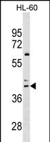 Rabbit Polyclonal Antibody to CCR4